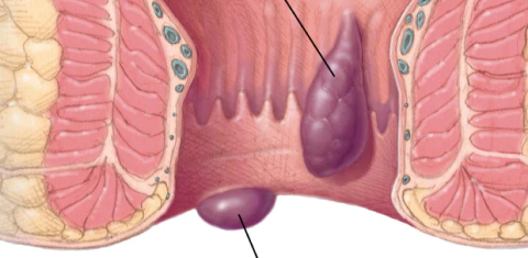 Rhinoplasty
