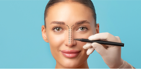 Rhinoplasty