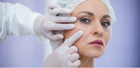 Rhinoplasty